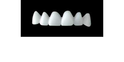 Cod.E3UPPER ANTERIOR : 10x  wax facings-bridges (hollow), MEDIUM, Square tapering, (13-23), compatible with solid (not  hollow) wax bridges Cod.S3UPPER ANTERIOR, (13-23)